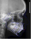 radiografa ortodoncia 02