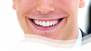 Estética-dental-sonrisa-pozuelo-aravaca