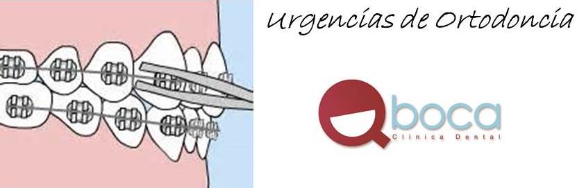 Urgencias-ortodoncia-Pozuelo-y-Aravaca-casos-frecuentes